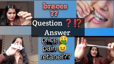 Braces question and answer#bracesjourney #questoinanswer#viralvlog
