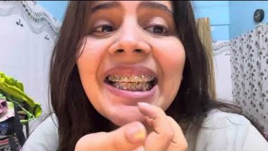 Braces lgane ke baad kitna pain hota ha 🥲🦷#viral #teeth #braces #trending #teethwhitening #dentalpro