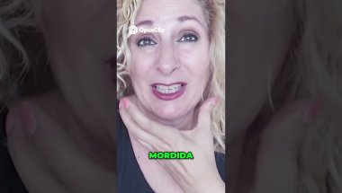Mi Experiencia Invisalign  Actualización y Resultados