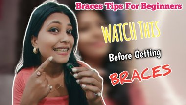 🦷😨 Teeth Correction With Braces l Braces लगवाने से पहले ये बातें जरूर जाने Pain, Cost, Braces types