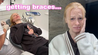 Getting Braces Fitted... *hurts so bad*