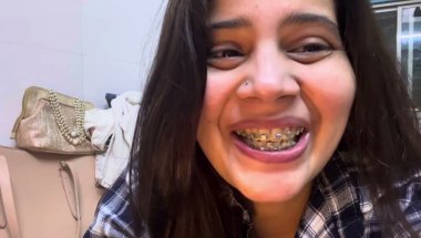 Braces lagwane ke baad pani puri kha sakte hai?#viral # #trending #smiledesigndental #teeth #braces