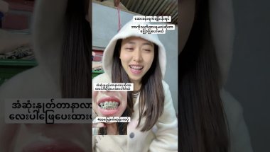Bracesရက်ချိန်းနီးရင်…