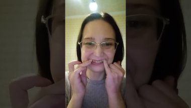 Как оно у меня про надеть /снять элайнеры