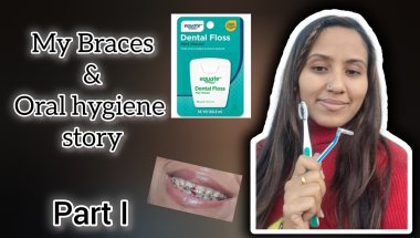 My braces experience+oral hygiene story / my braces journey #braces #bracesjourney #dentist #smile