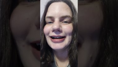Braces journey update from November 2025.