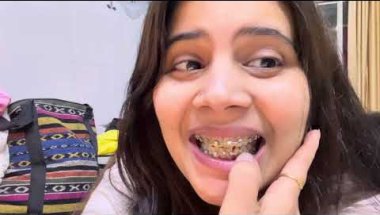 9Month 12 days braces update #viral #trending #dentalcare #teeth #dentalprosthesis #braces#youtuber