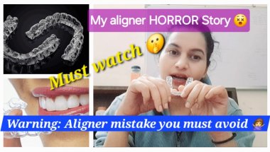 My scary aligner story 😱😬| #aligners #braces #dentalcare #smilemakeover #teeth #dentist #indore