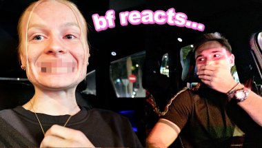 Boyfriend Reacts to my NEW BRACES...