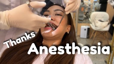 Braces Pain Got Me Looking Like This?! My Braces Experience with TADs and Swollen Jaw
