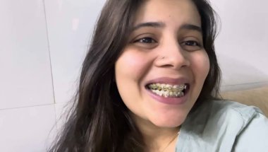 9 Months 14 days braces update#viral #trending #vlog #smiledesigndental #braces #teeth #youtubeshort