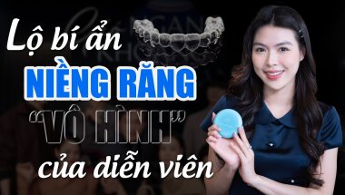 Niềng Răng "Vô Hình" - Lựa Chọn Hàng Đầu Của Các Diễn Viên | Nam Bùi Vinalign