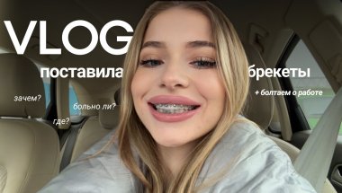 VLOG | Я ПОСТАВИЛА БРЕКЕТЫ | зачем и почему, первые ощущения // день на работе