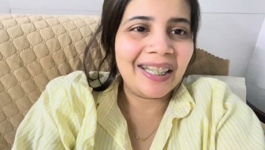 9Months 16 days braces update #viral #trending #dentalcare #trending #smiledesigndental #vlog #denta