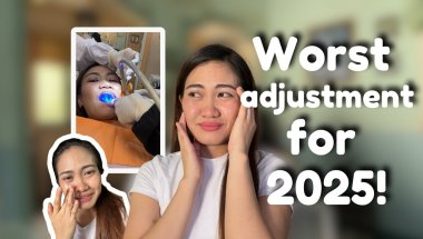 Lower Jaw is swollen! | Another TADs to go | November Braces Update