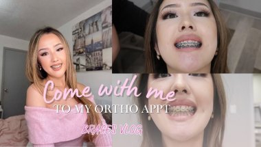 Braces Vlog Ep.13: Come with me to my ortho appointment🤍 | teeth updates, wires changed, power chain