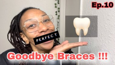 BRACES REMOVAL DAY • COME WITH ME • RETAINER CHECK • GOODBYE GAPS • THE END OF MY BRACES JOURNEY