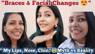 🦷😍 Braces & Facial Changes: My Lips, Chin - ( Myth vs Reality😨) #braces #bracesmyths #transformation