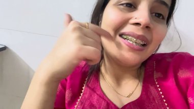 Dark reality of braces#viral #trending #dentalcare #dentalcare #smiledesigndental #teeth #braces