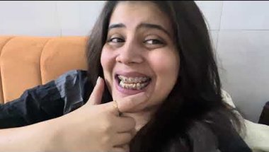Braces ki sachai#viral #vlog #trending #dentalcare #smiledesigndental #teeth #braces #youtuber #vira