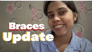 Braces update-Tightening #explore #braces #bracestreatment #information