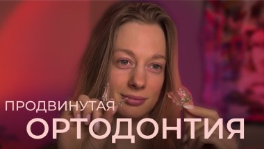 Ровные зубы без брекетов и операций: мой опыт