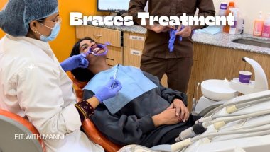Braces journey starts here
