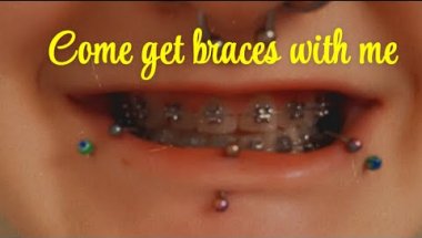 Get braces with me 🫶🏼 #braces