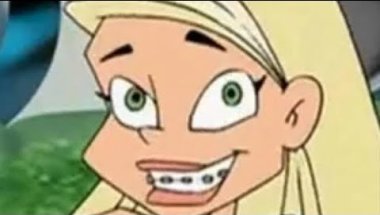 I Finally Got My Braces!