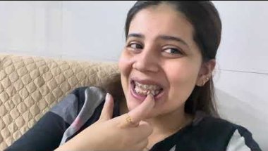 Doctor braces me power chain kb lgate hai#viral #dentalbraces #trending #vlog #dentalcare #youtuber