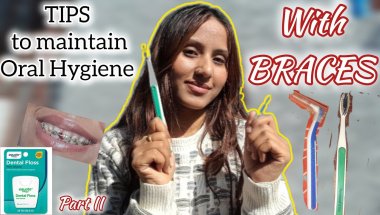 Braces Oral Hygiene Tips | Avoid Cavities & Bad Breath /mybracesjourney #braces #bracesjourney