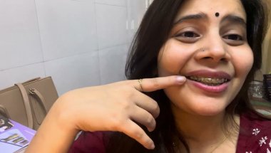 Braces Emi pe lagte hai?🤑🦷#viral #vlog #trending #dentalcare #smiledesigndental #teeth #braces