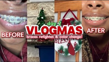 I GOT BRACES!! Part 3 | retighten & color change | Vlogmas day 3 | Brya Life