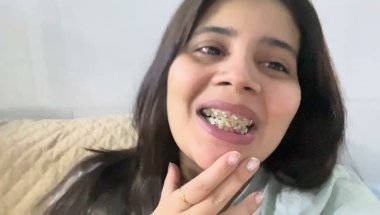 दातो के गैप कितने दिन में भरते हैं #viral #trending #dentalcare #dentist #teeth #braces #youtuber