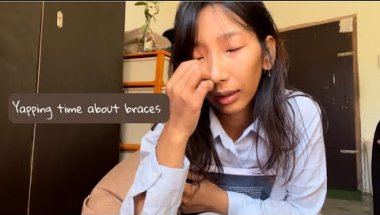 [Braces Epilogue]Not satisfied with my results 🥺 #braces