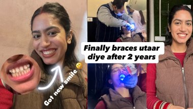 Finally Braces Utaar Diye After 2 Years 🥹 |Story Time ‼️ #dailyvlog #vlog #bracesoff #bracesremoval