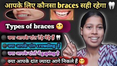 Types of braces😬🦷|| आपके लिए कौनसा braces सही रहेगा || #dentist #dental #clearaligners #viral #vlog