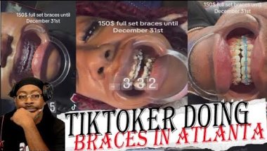 Atlanta TikToker is Doing Power Chain Braces for $150