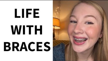 Braces Update: Rubber Bands, Progress & What’s Next in My Braces Journey
