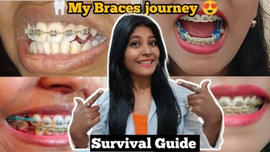 My Braces Pain : Honest Story 😨 ll My Braces Pain : UNFILTERED Story (Sept 2025 Update