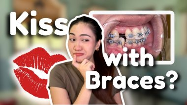 Q&A Common Questions about Braces Part 1 Unfiltered