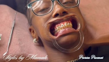 Styles By Mamah Achieve Your Smile (Braces) ad