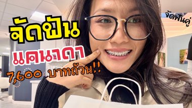 [ep.410]  ￼ จัดฟันครั้งแรก ที่แคนาดา: ￼ ถูกขนาดนี้ ไม่จัดได้ไง: งานนี้ฝรั่งก็จัดด้วย  จัดฟันคู่