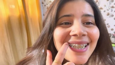 How to clean your teeth with braces💡#viral #trending #dentalcare #smiledesigndental #teeth