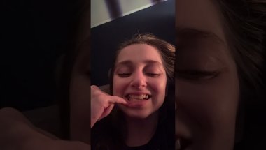 Shauna Rae: Invisalign Day 119