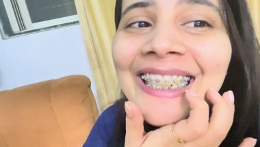 Power chain keise work krta hai#viral #minivlog #trending #teeth #braces #dentalcare #viralvideo