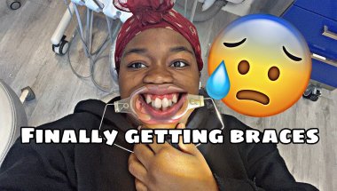 I’m finally getting braces