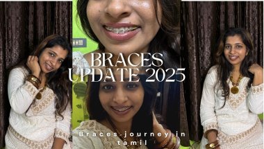 Braces update 2025| Braces journey in Tamil | self motivation | All about braces