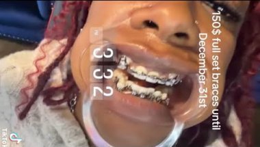 She’s doing BRACES out of her HOUSE!!! Have you ever seen this?