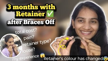 This is how I clean my Retainers || retainer loose ho gye? || What to expect after Braces Off 😵